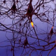Illustration for article titled How We Discovered Alzheimers Disease